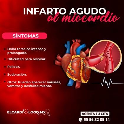 Infarto al miocardio.
