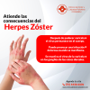 Atiendete las consecuencias del Herpes Zóster